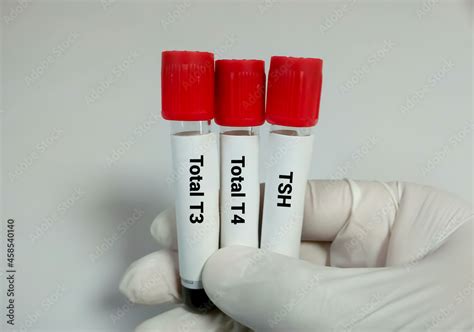 thyroid blood test bottle colour|blood bottle testing instructions.